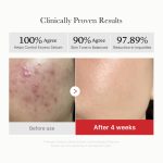 [GIFT] Red Succinic Acid Panthenol Pads