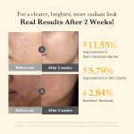 Kojic Acid Turmeric Capsule Serum