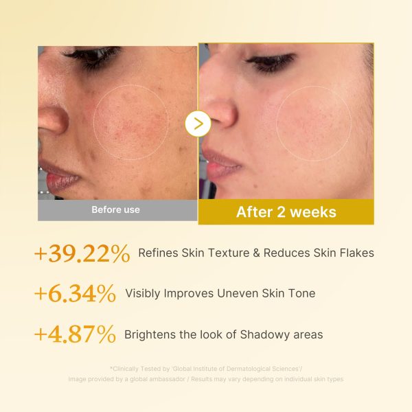 Kojic Acid Turmeric Toner