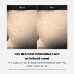 [Subscr.] Zero Pore One-day Serum