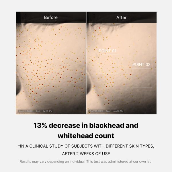 [Subscr.] Zero Pore One-day Serum